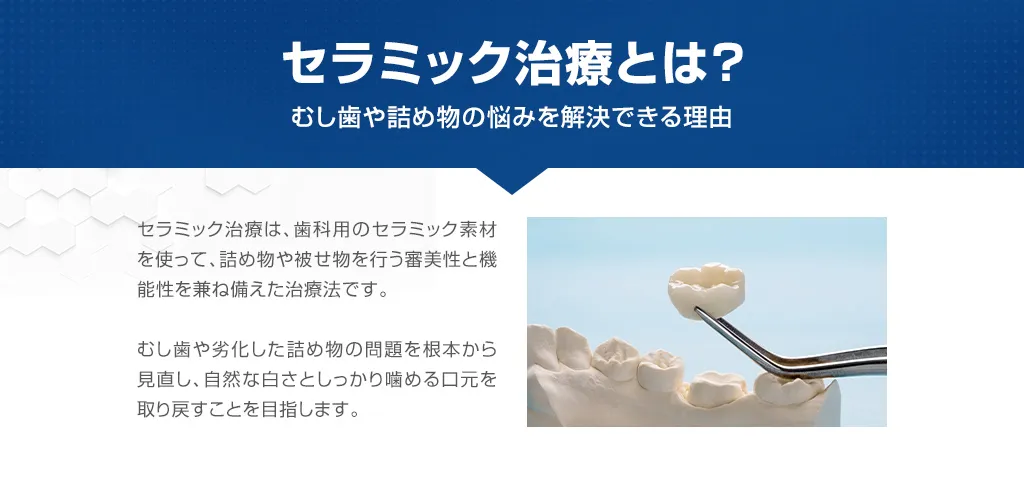 セラミック治療とは？
