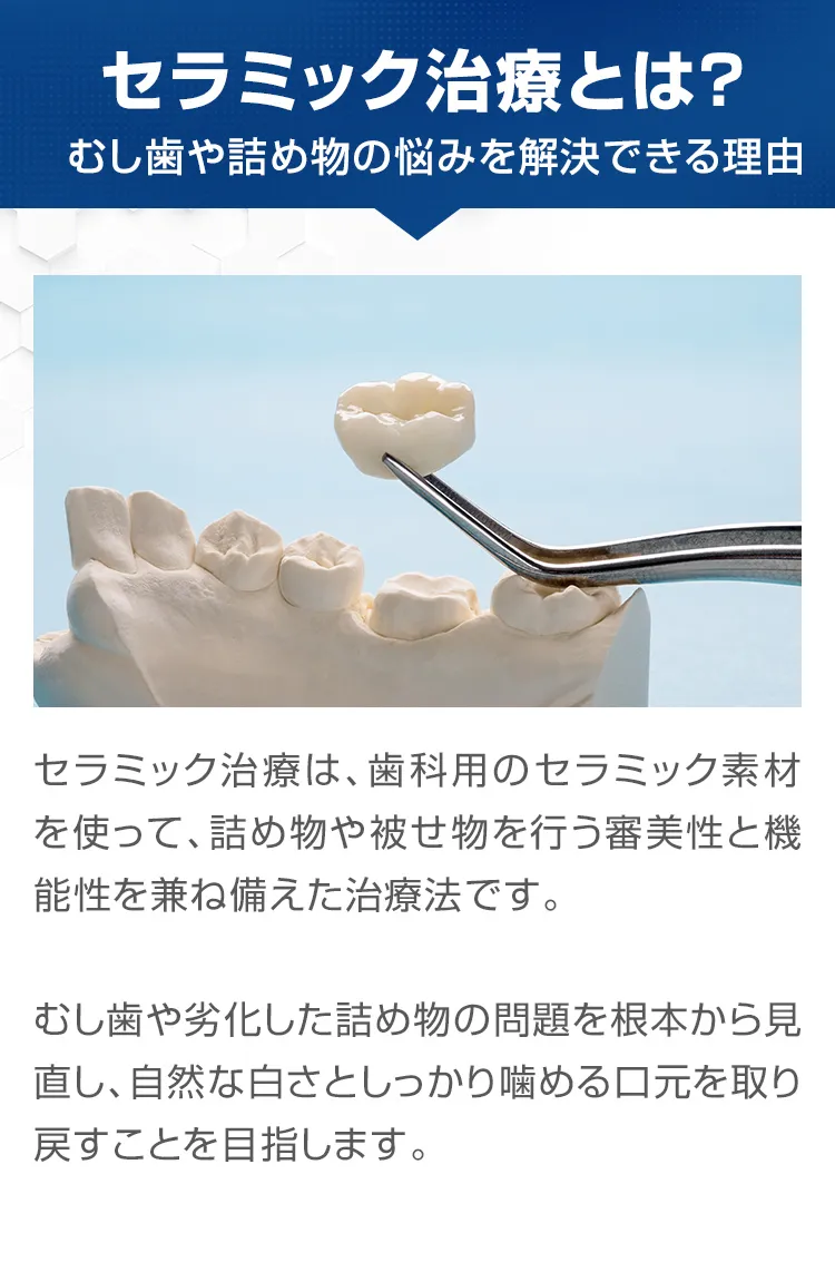 セラミック治療とは？