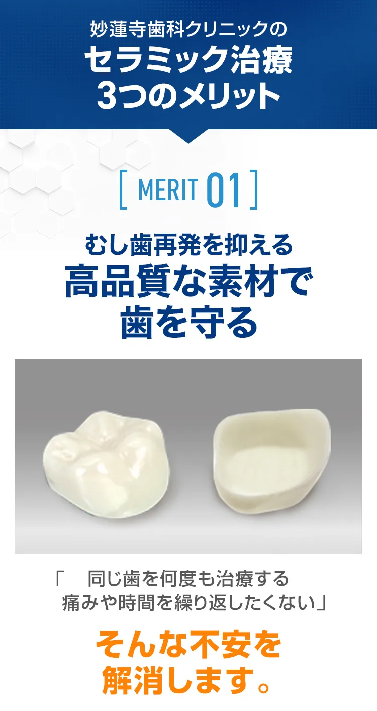 セラミック治療3つのメリット