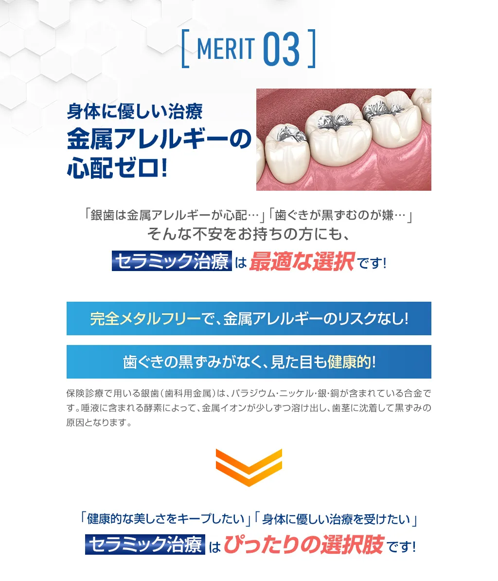  身体に優しい治療｜金属アレルギーの心配ゼロ！