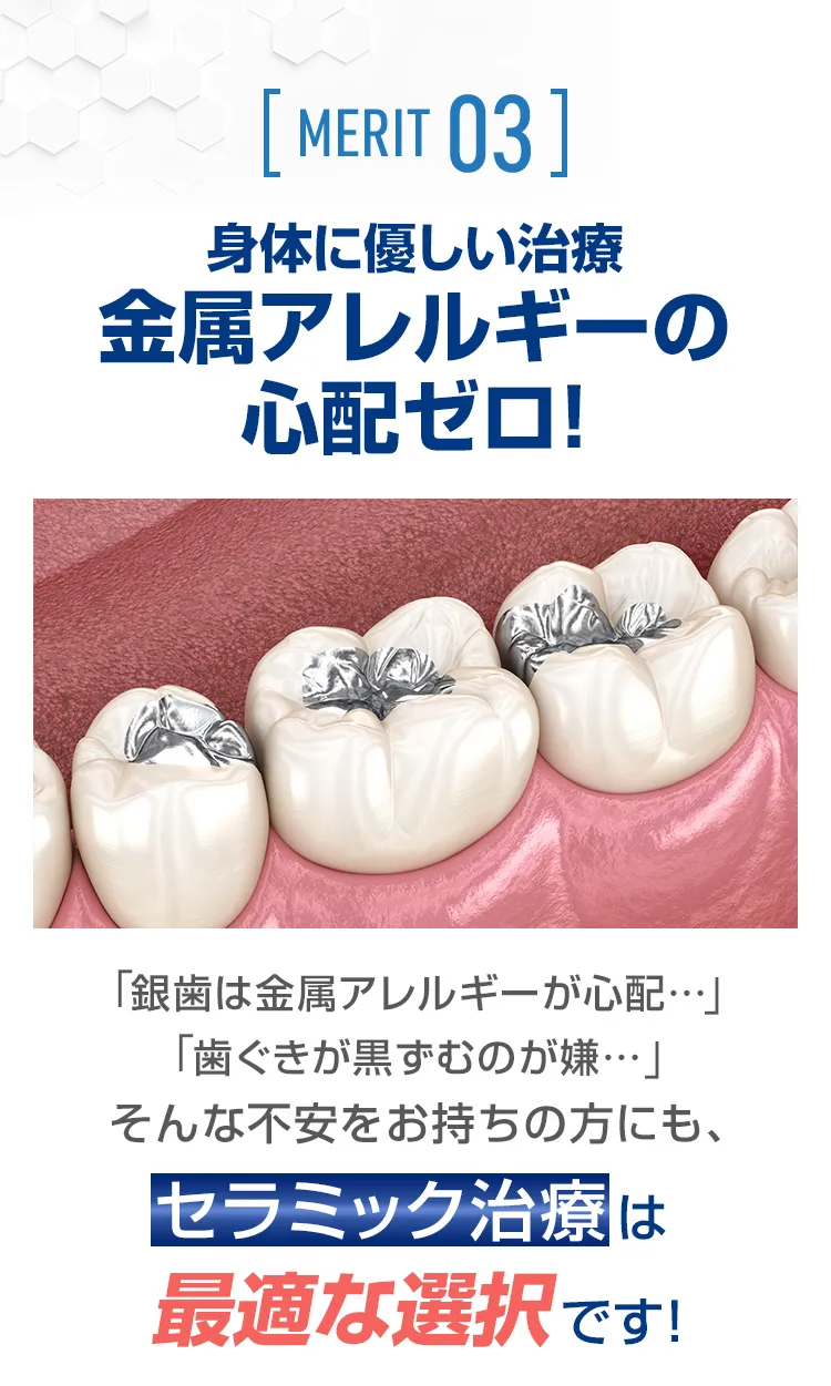  身体に優しい治療｜金属アレルギーの心配ゼロ！