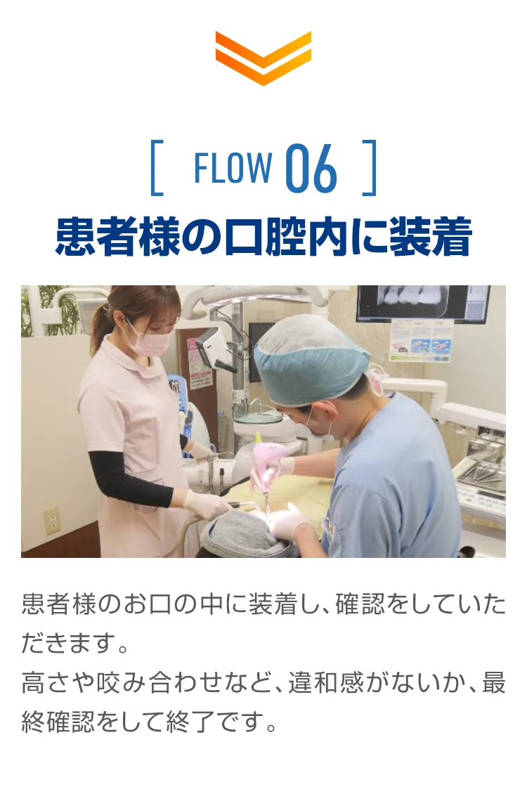 セラミック治療の流れ