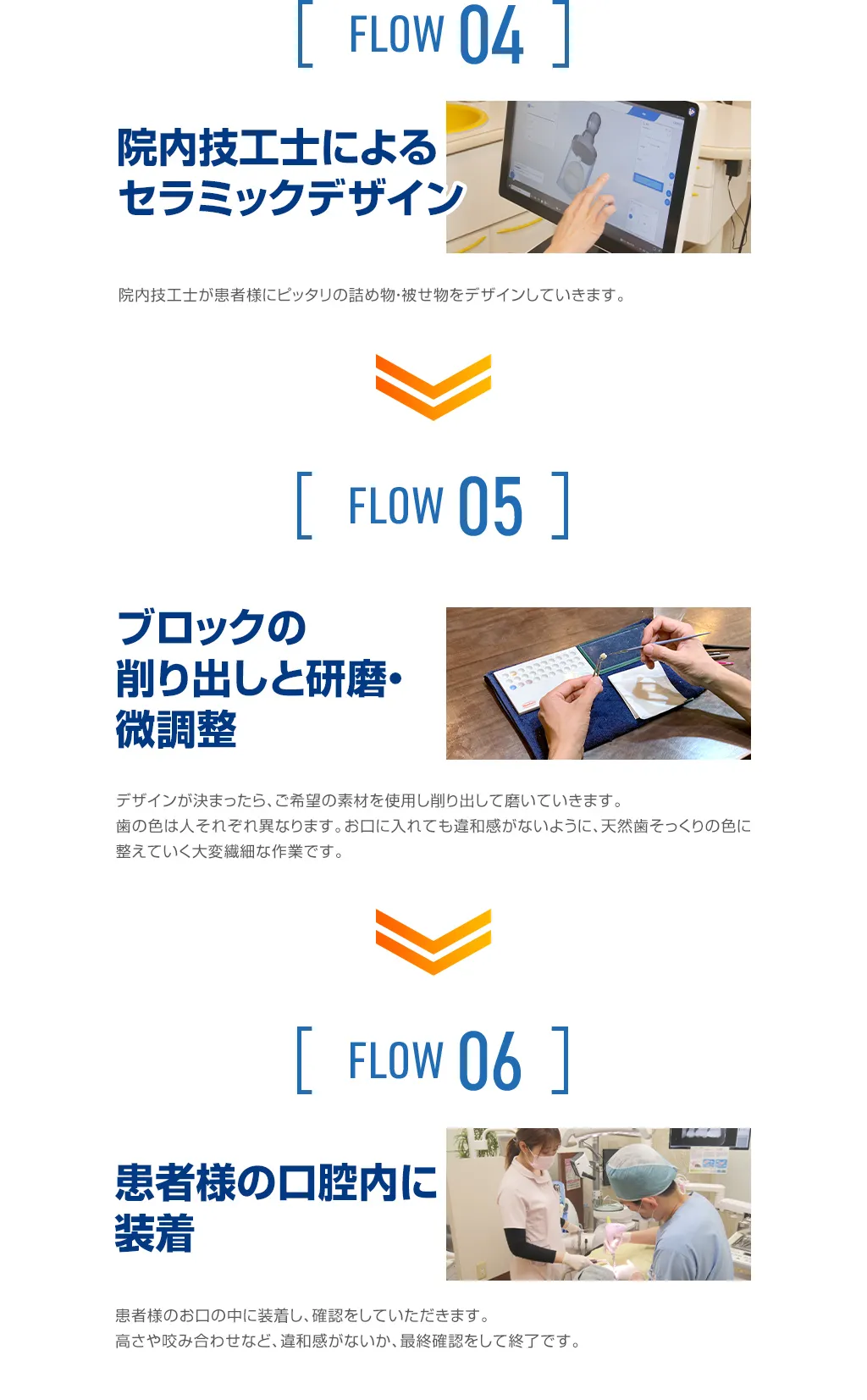 セラミック治療の流れ