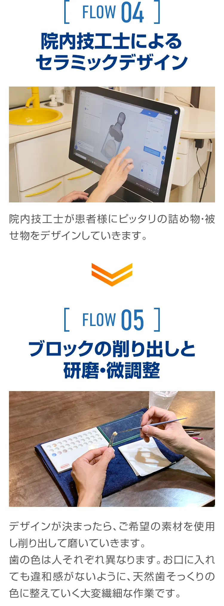 セラミック治療の流れ