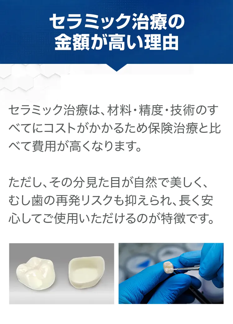 セラミック治療の金額が高い理由