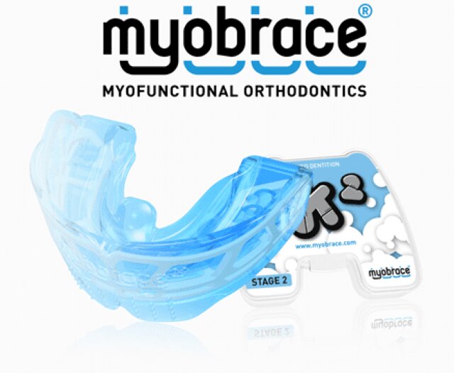 青いマウスピースとパッケージ