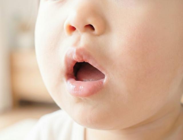 子どもの「お口ぽかん」は大丈夫？原因と歯並びへの影響｜妙蓮寺歯科クリニック